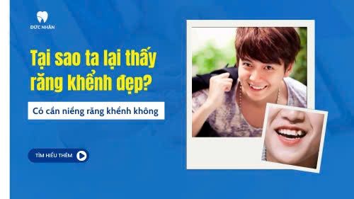 Tại sao ta lại thấy răng khểnh đẹp? Có cần niềng răng khểnh không