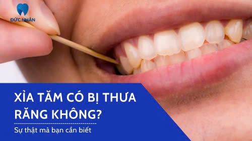 Xỉa tăm có bị thưa răng không? Sự thật mà bạn cần biết