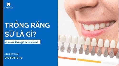 Trồng răng sứ là gì? Vì sao nhiều người chọn làm
